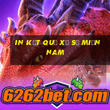 in kết quả xổ số miền nam