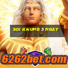 soi khung 3 ngay